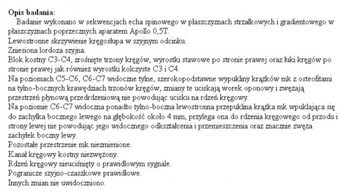opiniaMRIszyjny.jpg (222.5 KiB) Przejrzano 36990 razy opinia lekarska po RMI odcinka szyjnego